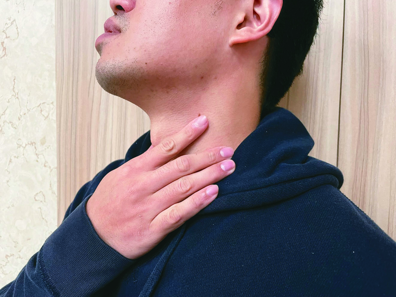 胃酸逆流 小心巴瑞特氏食道癌變