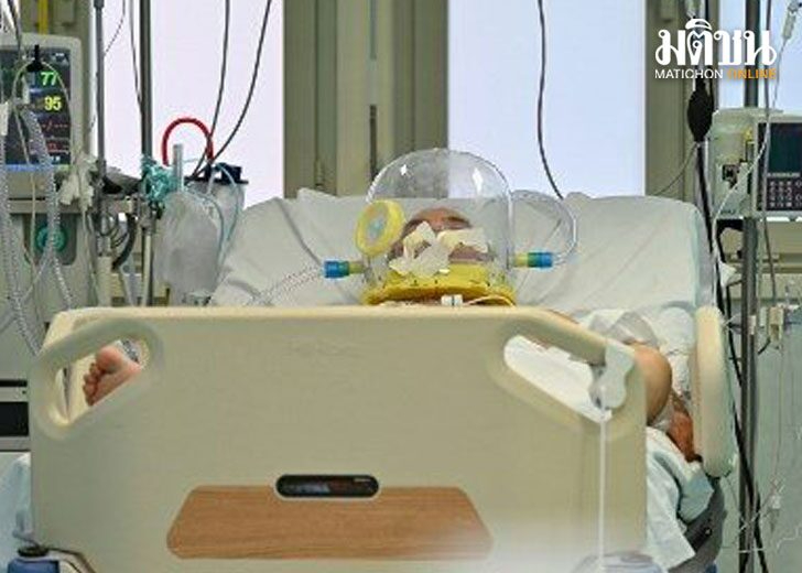 愛爾蘭男子遊泰 被蚊子咬傷重病