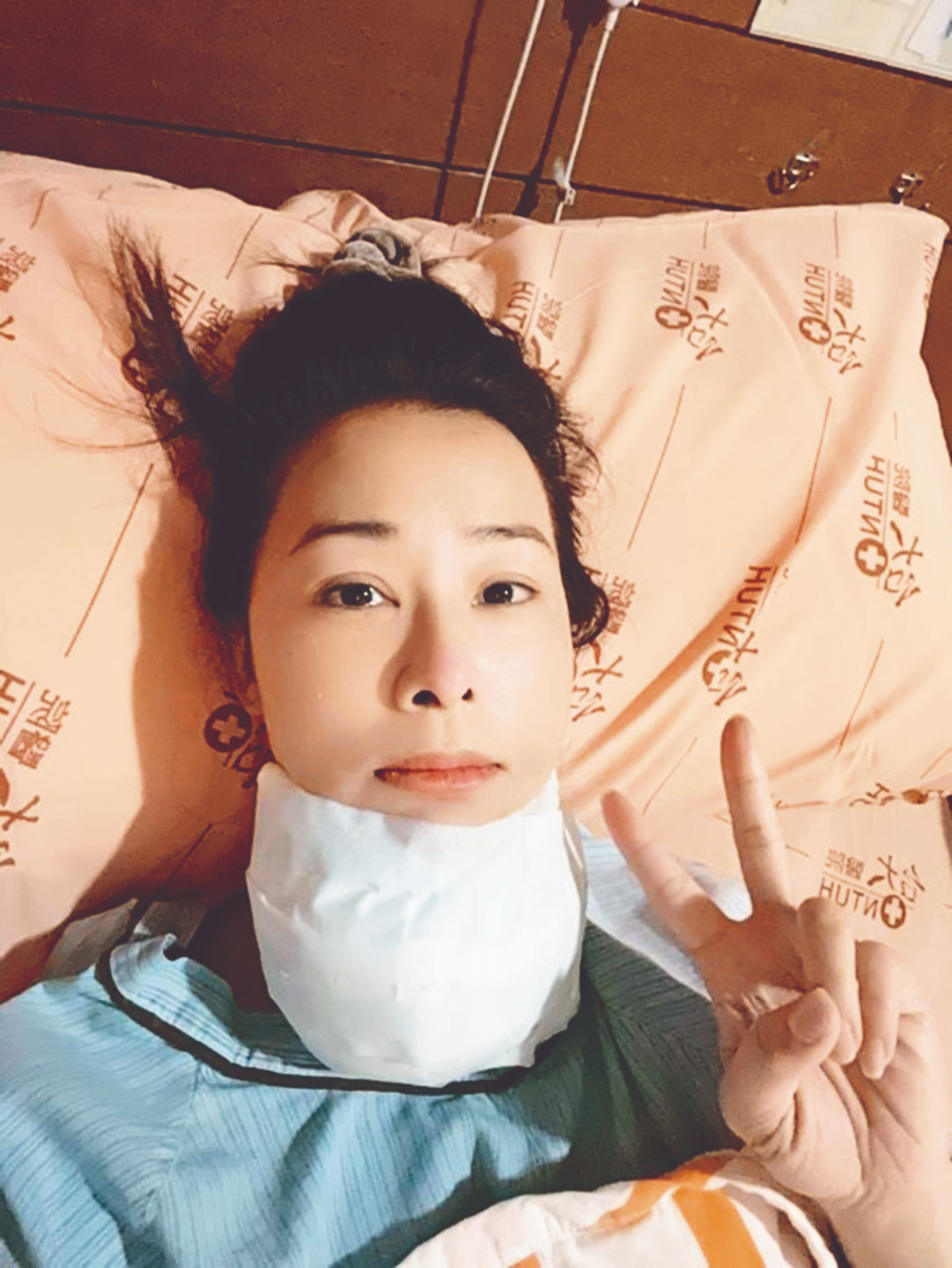 不明沙啞、咳嗽 留意甲狀腺癌