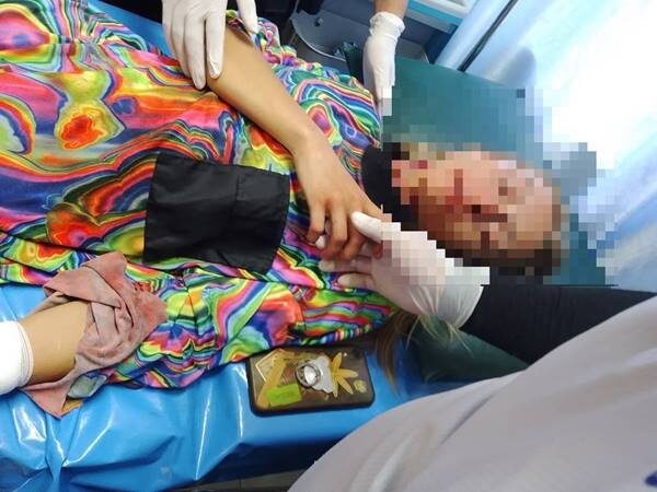 俄國女一身傷 疑驚嚇過度暫失記憶