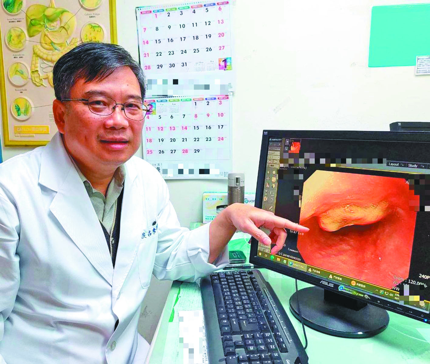 他解黑便胸腹痛 查出食道癌2期