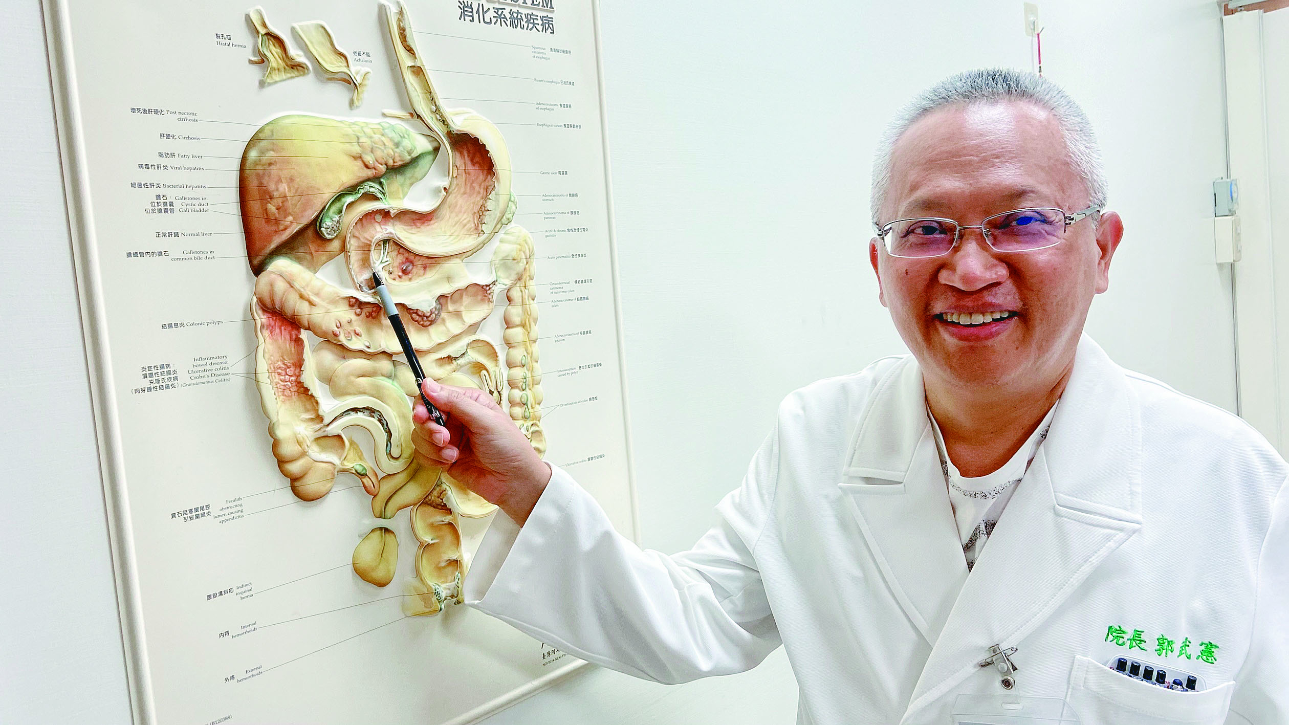 黃疸、紅茶尿 當心十二指腸壺腹癌